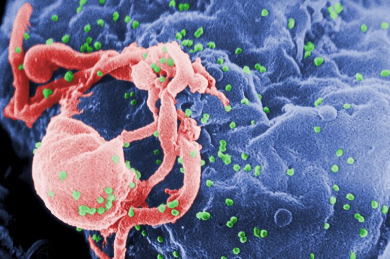 HCV e HIV a confronto, corso SIFO a Milano