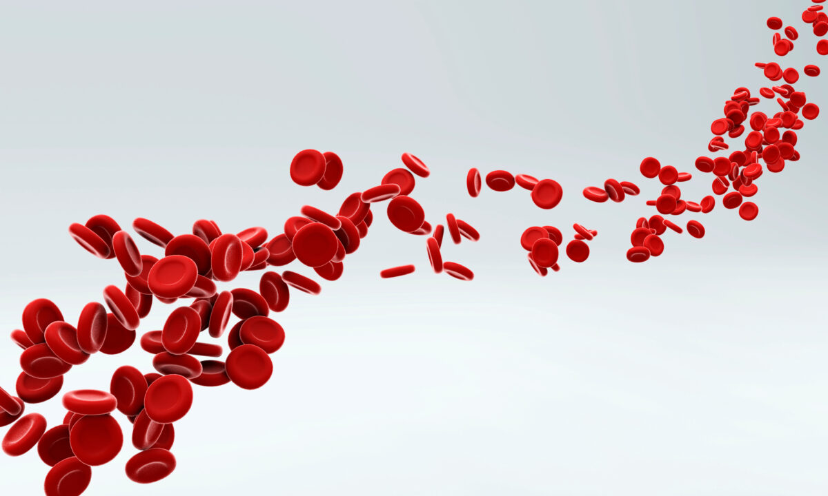 Approvato farmaco per anemia emolitica in pazienti con CAD